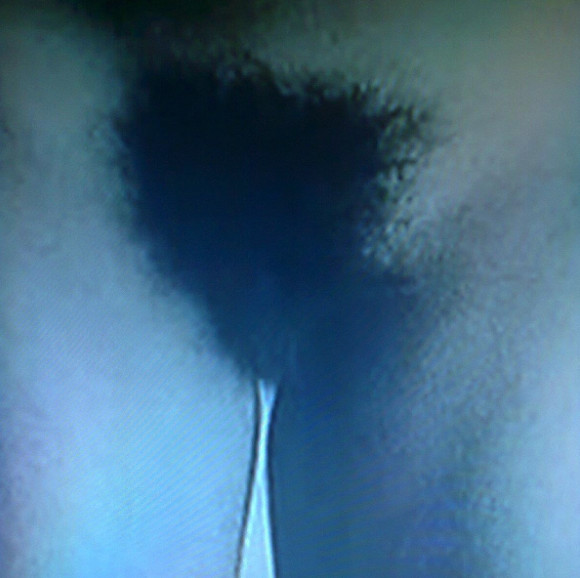 Quelle: Rosa Loch (@Schambehaarung) | Twitter